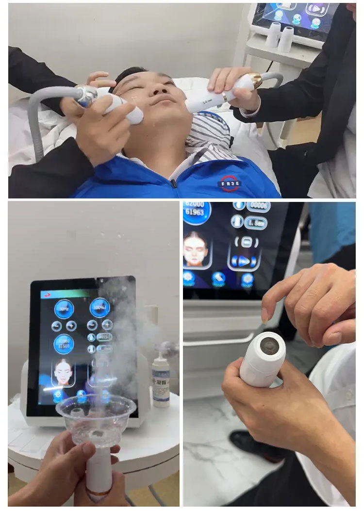 hifu facial machine