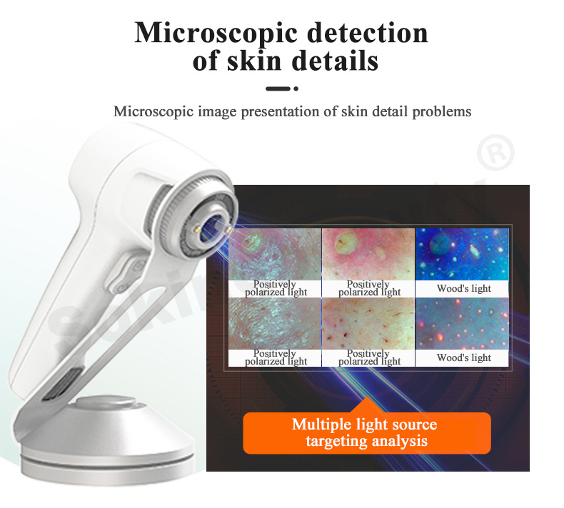 skin analysis machine cost