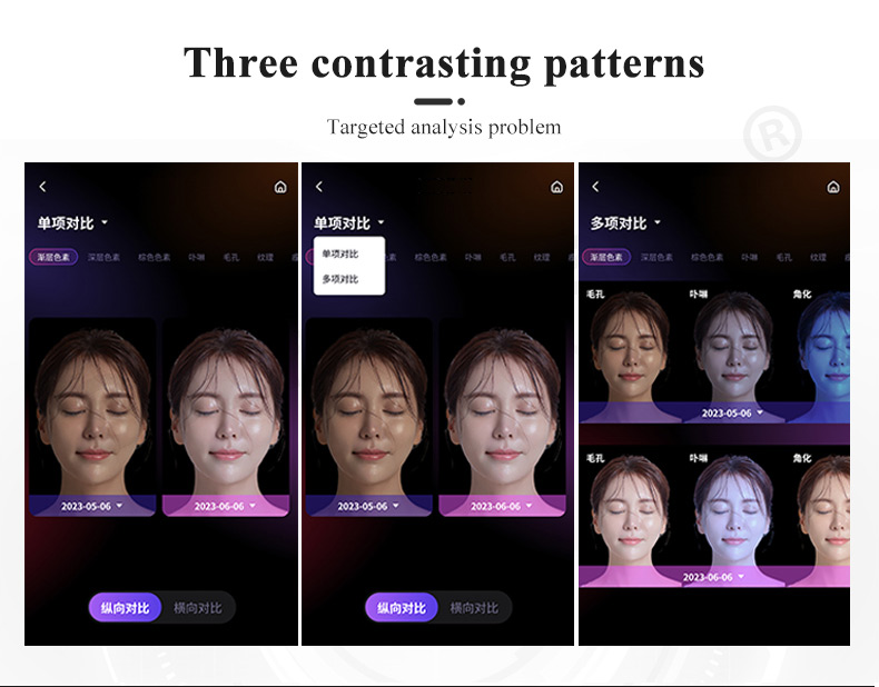 skin analysis machine cost