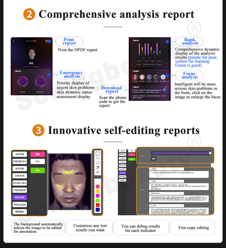 skin analysis machine cost