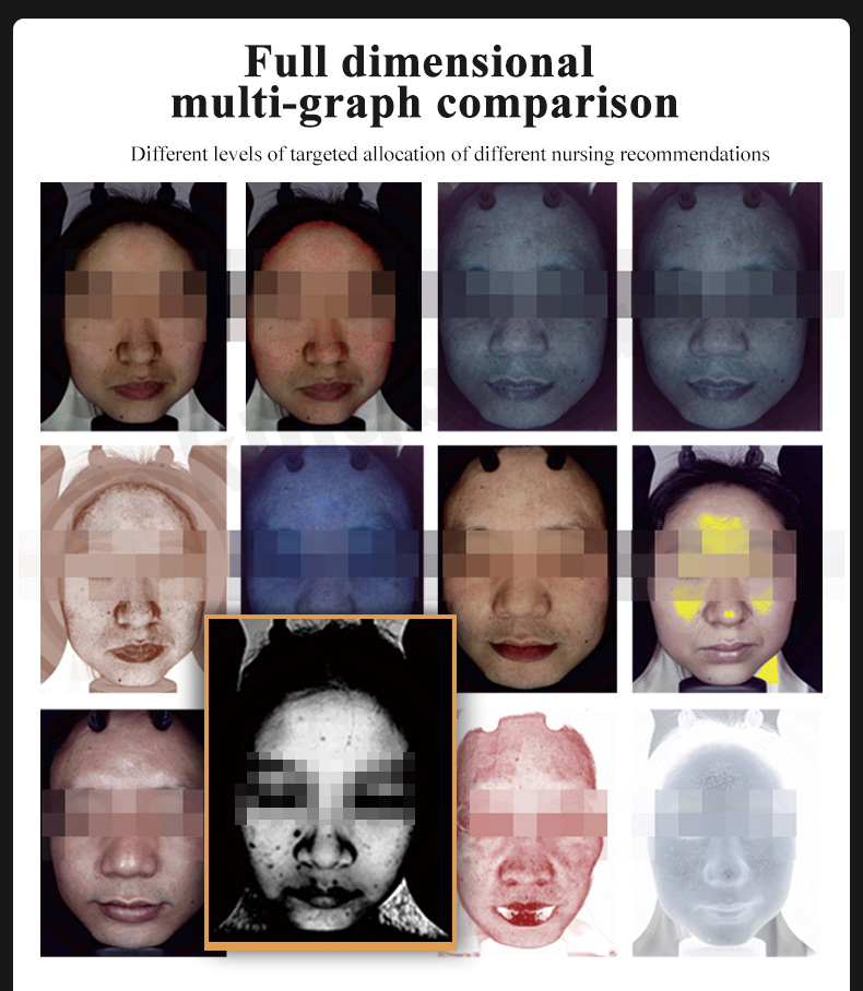 skin analysis machine cost