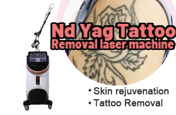 Nd Yag Tattoo Removal laser machine