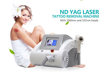 nd yag laser