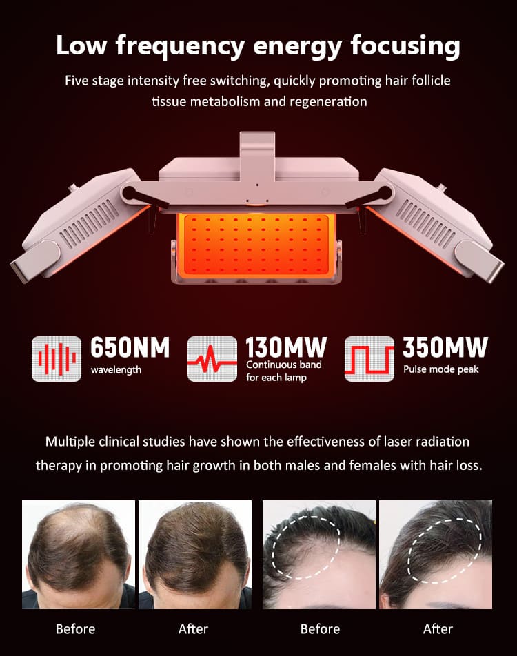 hair loss treatment machine