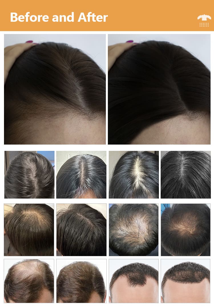 hair growth before after