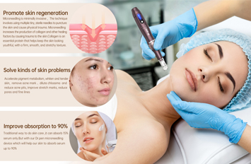 electric microneedle pen