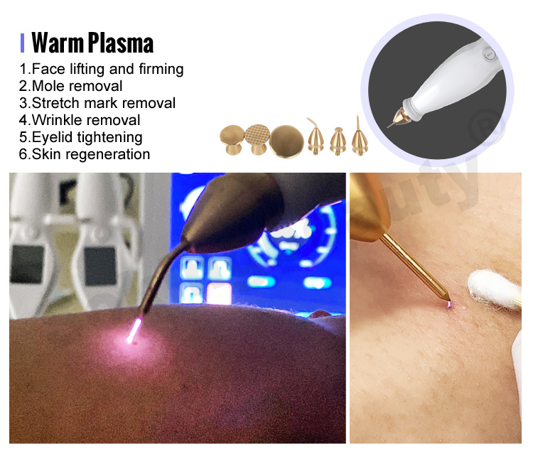 plasma pen fibroblast machine