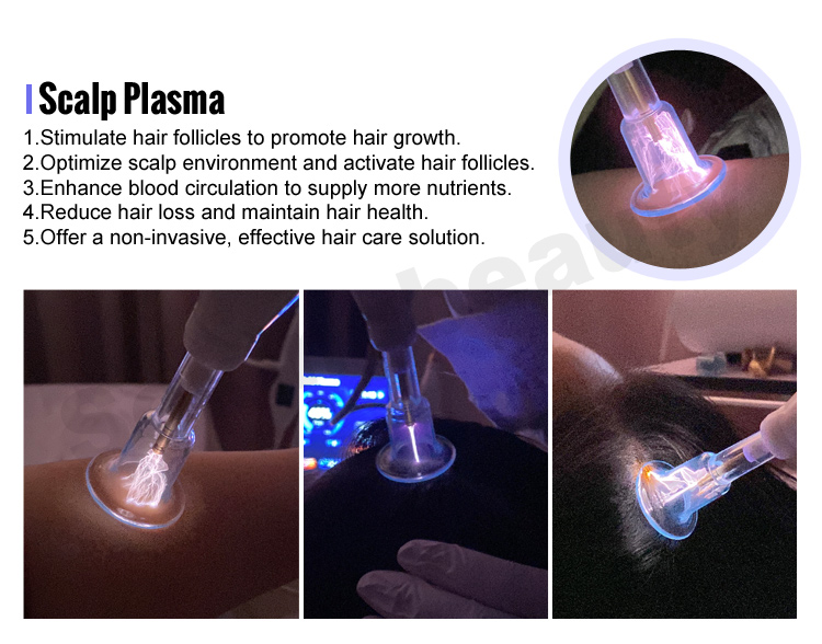 plasma pen fibroblast machine