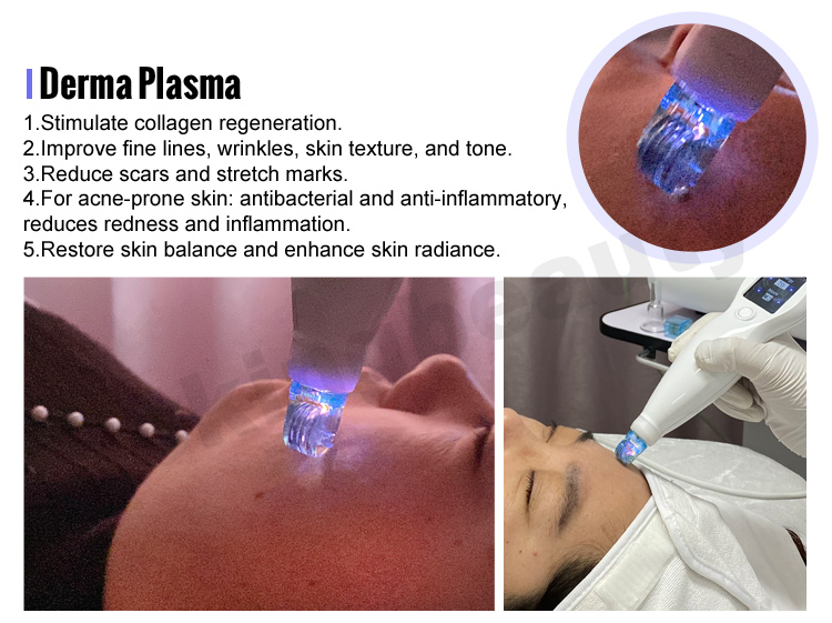 plasma pen fibroblast machine